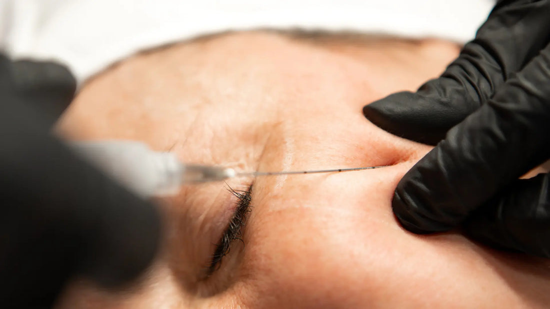 Bioestimuladores: la guía esencial para saber si este tratamiento es para ti