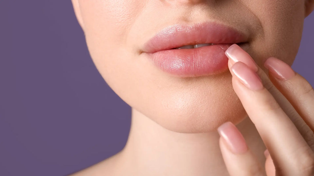 Herpes labial y relleno de labios: lo que debes saber antes de realizarte el tratamiento